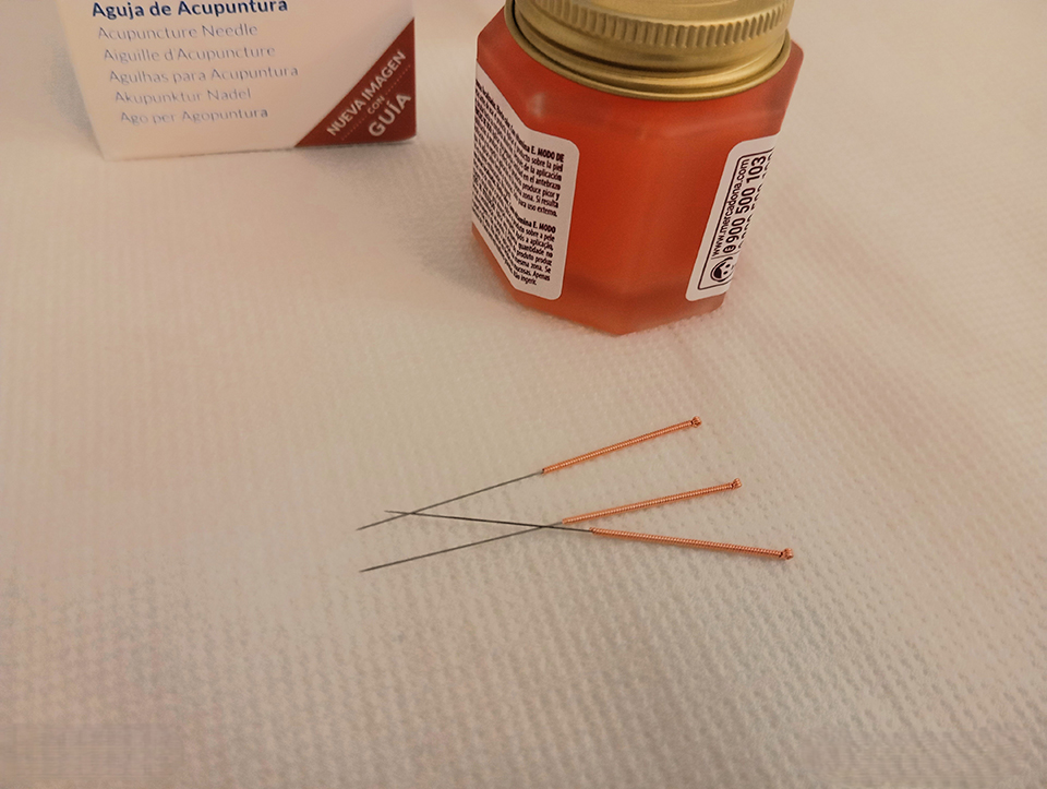 Acupunctura