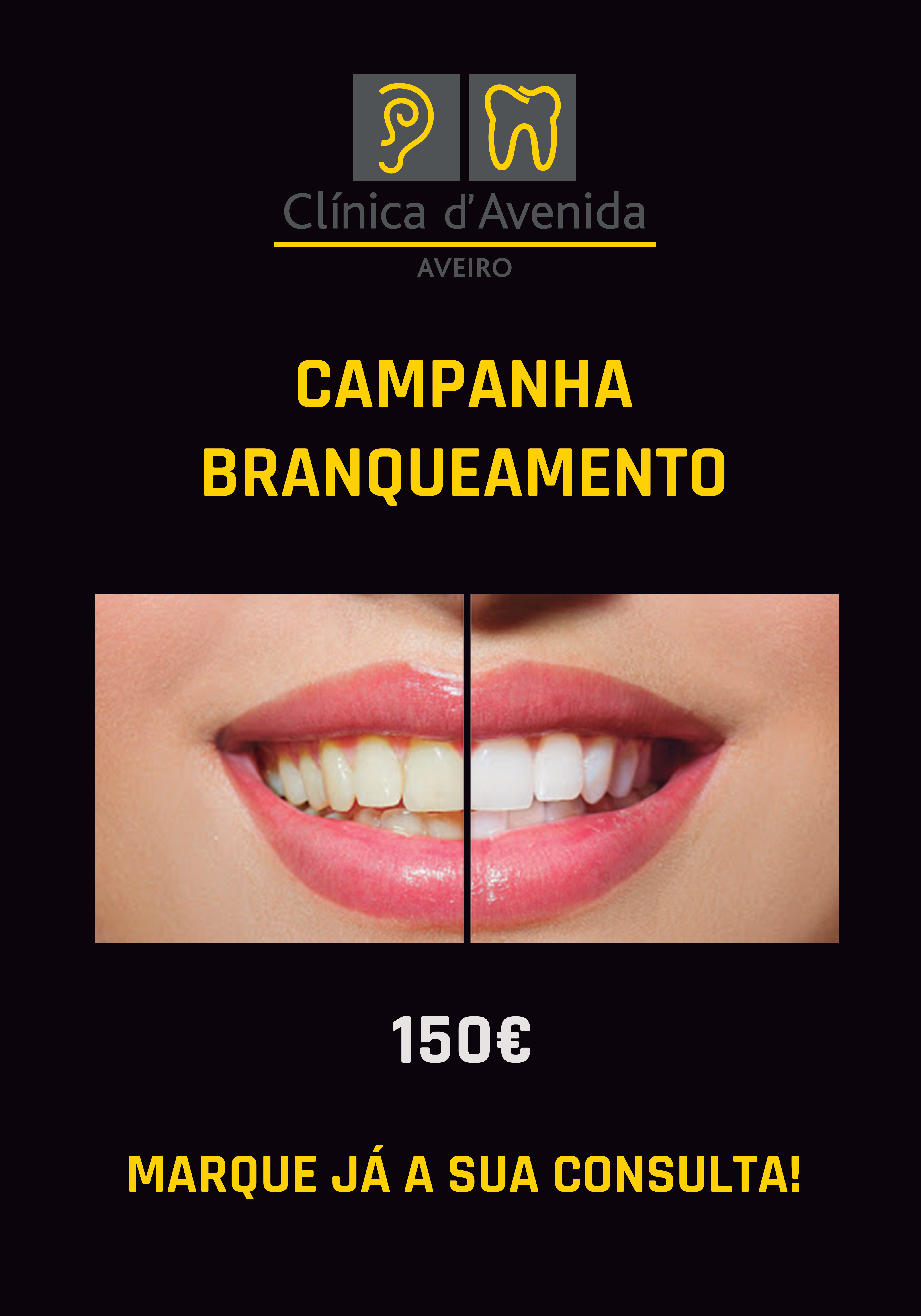 Campanha Branqueamento Campanha Branqueamento