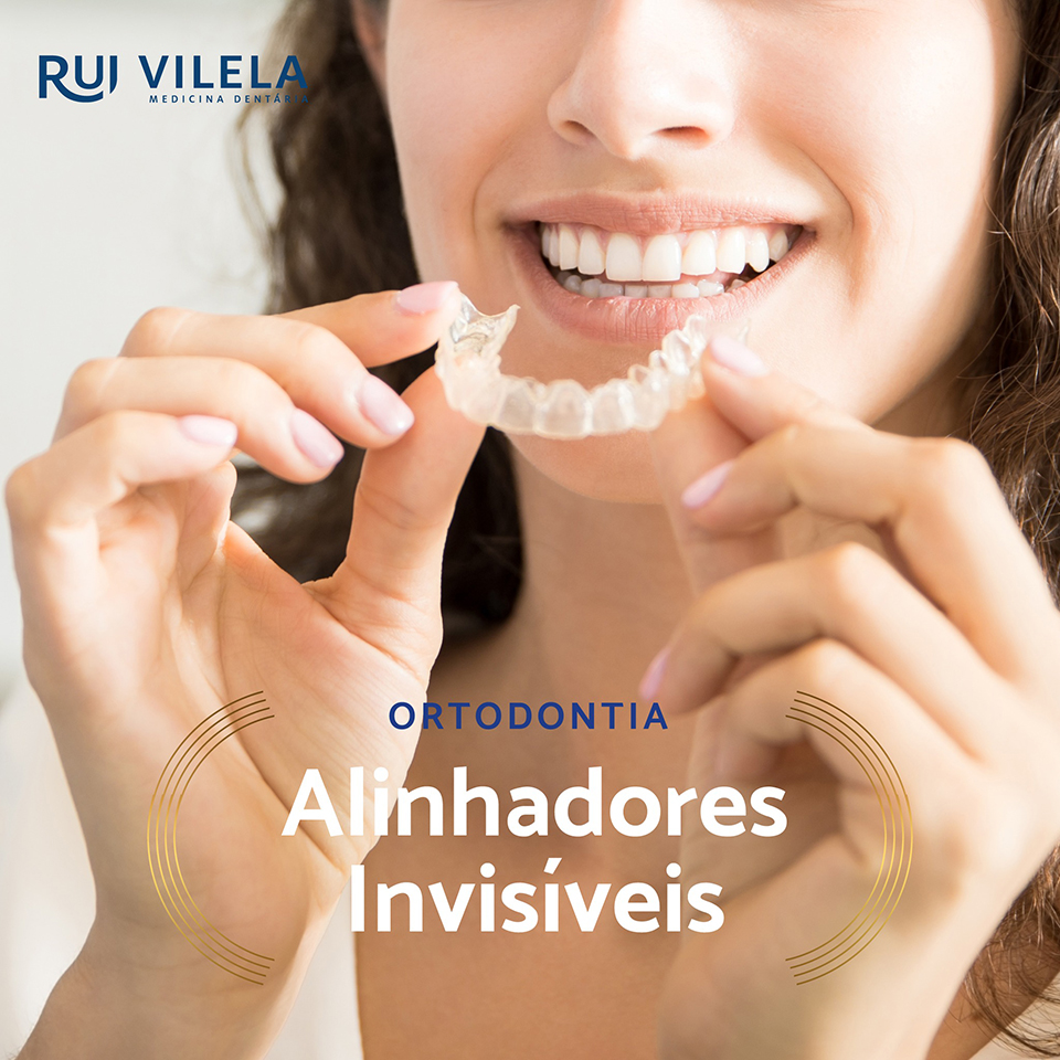 Alinhadores Invisiveis