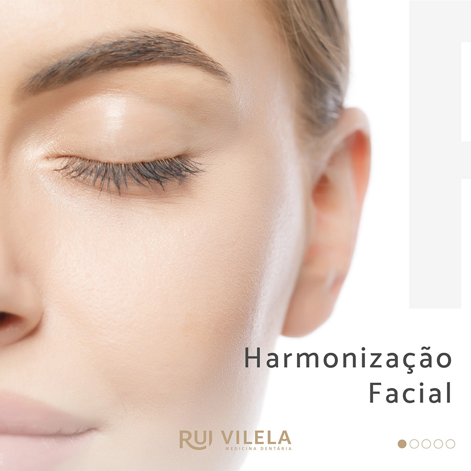 Harmonização Facial