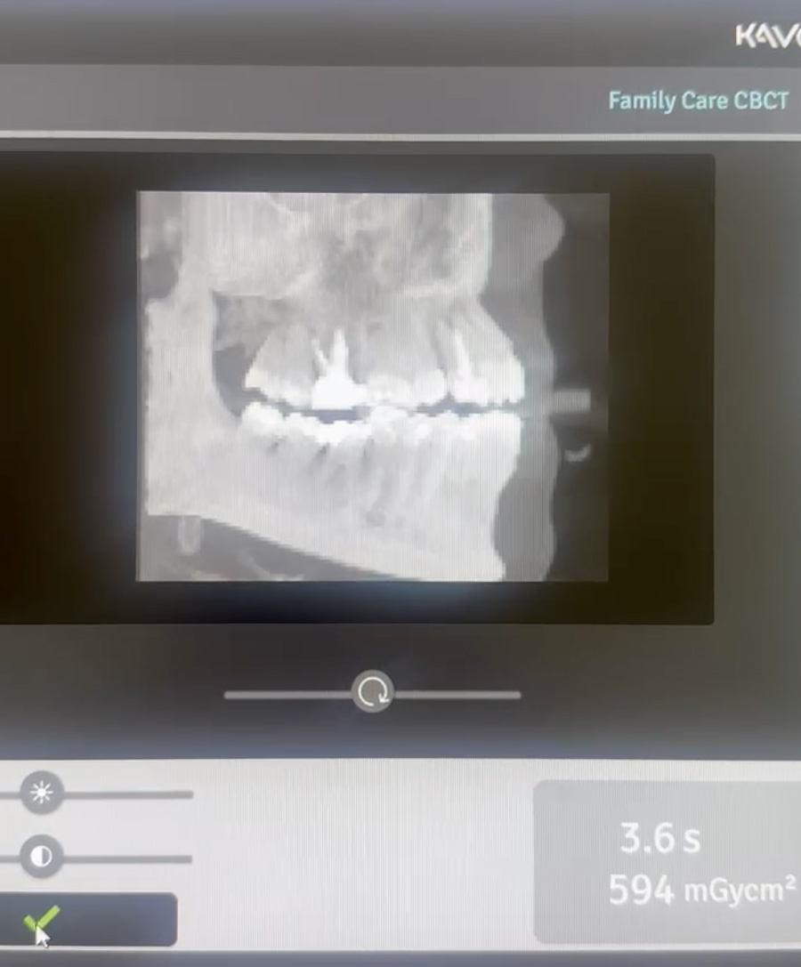 Tomografo CBCT