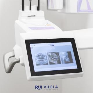 Tomografia Computorizada Dental