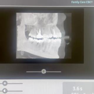 Tomógrafo CBCT