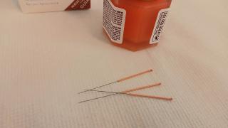 Acupunctura