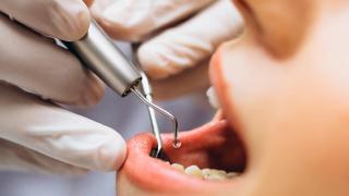 Periodontologia