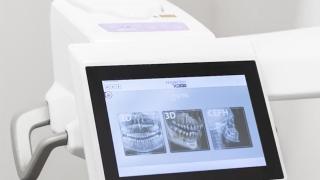 Tomografia Computorizada Dental