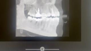 Tomógrafo CBCT